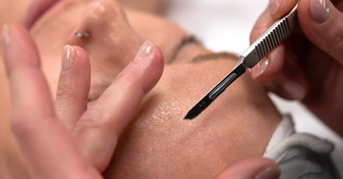 Dermaplaning